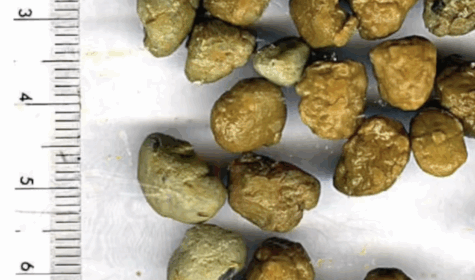 Liver Lung Detox Alert